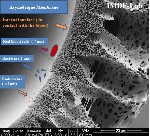 Hollow fiber Asymetrique membrane